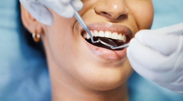 Best Root Canal Emergency Dentist  in Malakoff, TX